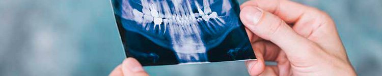 Рентген зубов на Бабушкинской